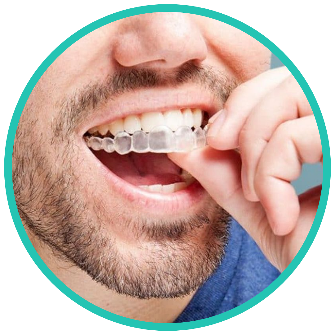 Invisalign masc Saigh Clínica